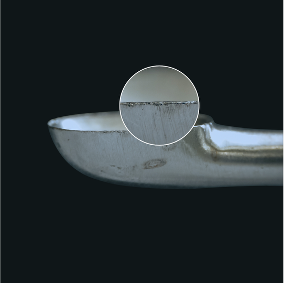 Before curette